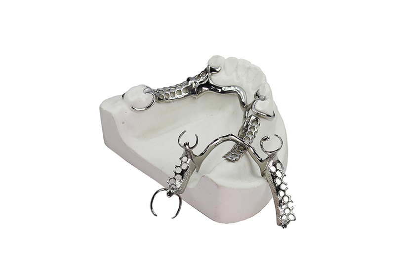 Titanium Partials